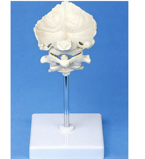 Medical Teaching Model Occipital Bone With Atlas And Axis Model Skeletal Model