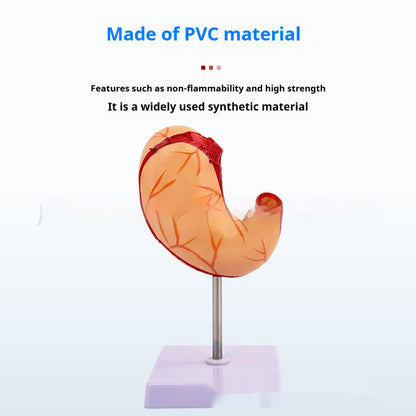 Human Digestive System Model Gastric Coronal Section Anorectal Anatomy Medical Teaching Aid For Gastroenterology