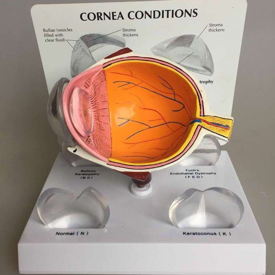 Supply Eye Disease Corneal Disease And Medical Teaching Instructional Models