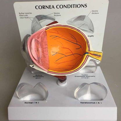 Supply Eye Disease Corneal Disease And Medical Teaching Instructional Models