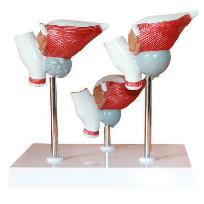 Medical Prostate Pathological Anatomy Model Teaching Aid For The Male Reproductive System
