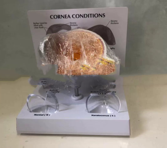 Supply Eye Disease Corneal Disease And Medical Teaching Instructional Models
