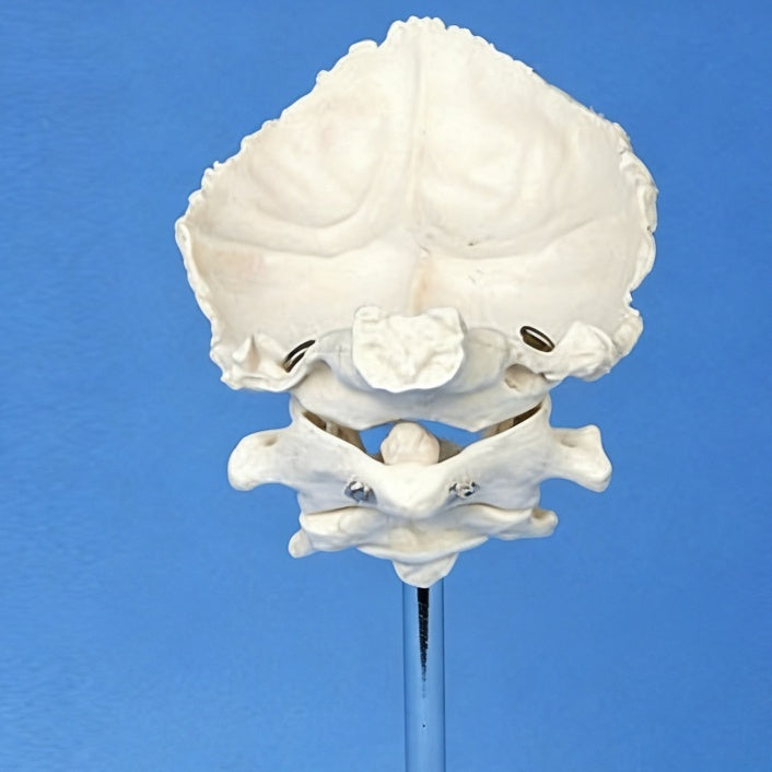 Medical Teaching Model Occipital Bone With Atlas And Axis Model Skeletal Model