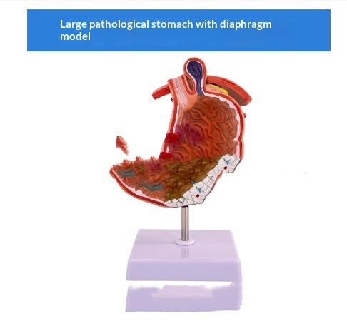 Human Digestive System Model Gastric Coronal Section Anorectal Anatomy Medical Teaching Aid For Gastroenterology