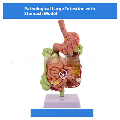 Human Digestive System Model Gastric Coronal Section Anorectal Anatomy Medical Teaching Aid For Gastroenterology