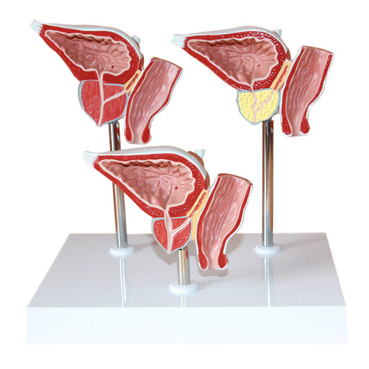 Medical Prostate Pathological Anatomy Model Teaching Aid For The Male Reproductive System