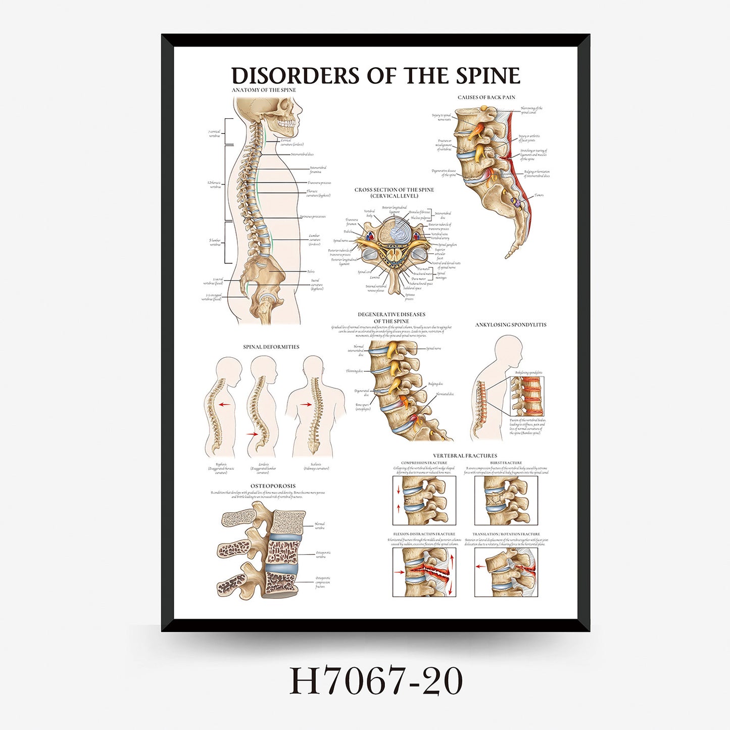 Wall Chart Human Anatomy Muscles Gym Medical Education Decorative Painting