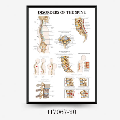 Wall Chart Human Anatomy Muscles Gym Medical Education Decorative Painting