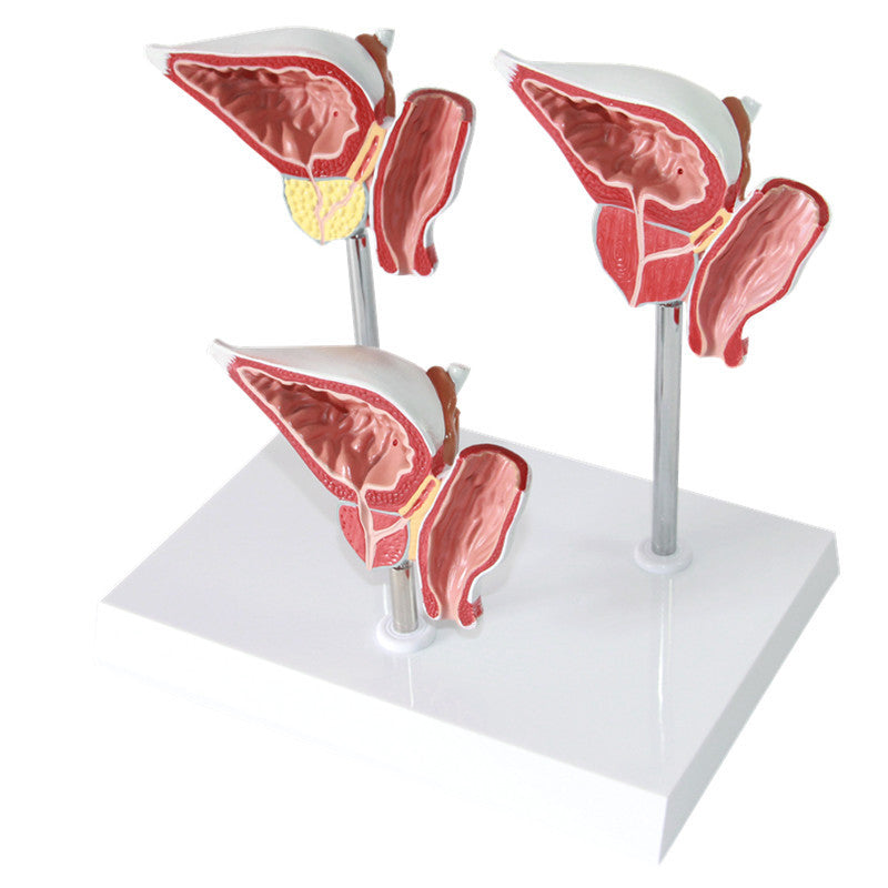 Medical Prostate Pathological Anatomy Model Teaching Aid For The Male Reproductive System