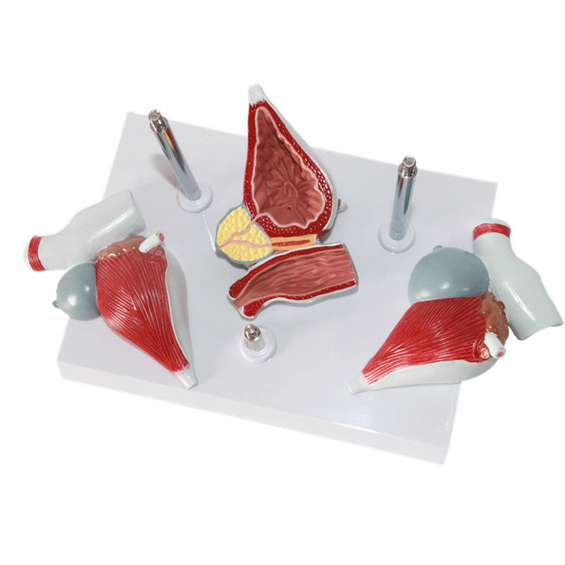 Medical Prostate Pathological Anatomy Model Teaching Aid For The Male Reproductive System