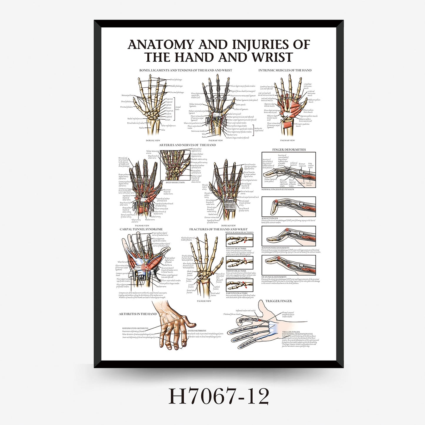 Wall Chart Human Anatomy Muscles Gym Medical Education Decorative Painting