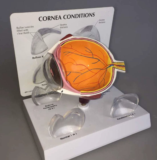 Supply Eye Disease Corneal Disease And Medical Teaching Instructional Models