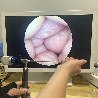 Medical CCD Endoscope Camera for ENT Inspection with F22mm Coupler Connect to Monitor
