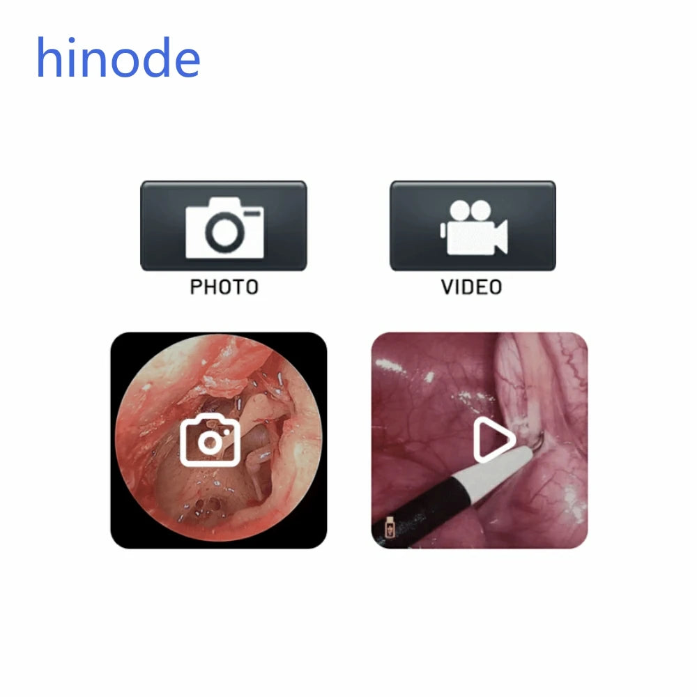 Hinode - HD Endoskopie-Kamerasystem 1920×1080P – Full-HD Bildgebung