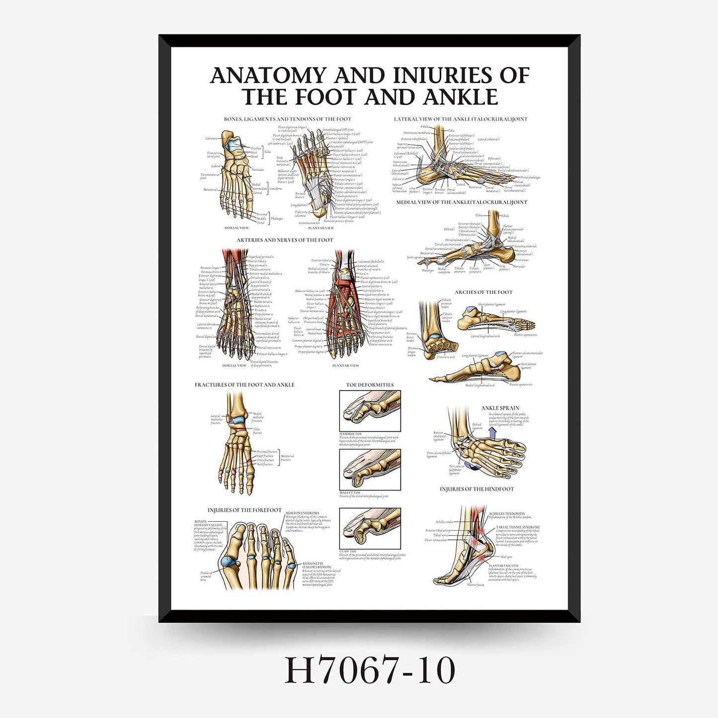 Wall Chart Human Anatomy Muscles Gym Medical Education Decorative Painting